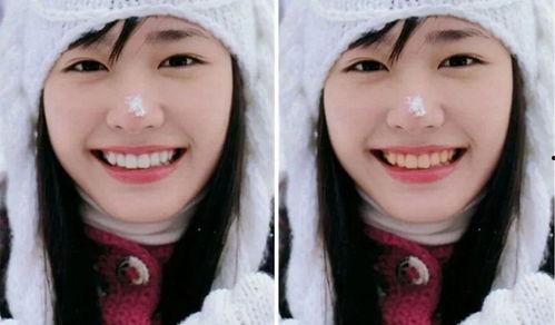 明星网红牙齿贴片选几号,选对号码，笑容更迷人