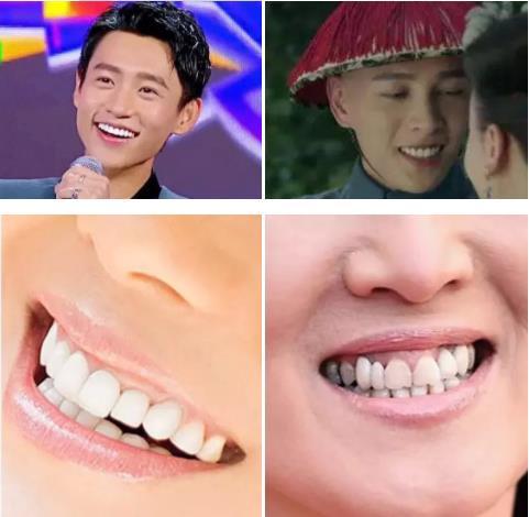 明星网红牙齿贴片选几号,选对号码，笑容更迷人